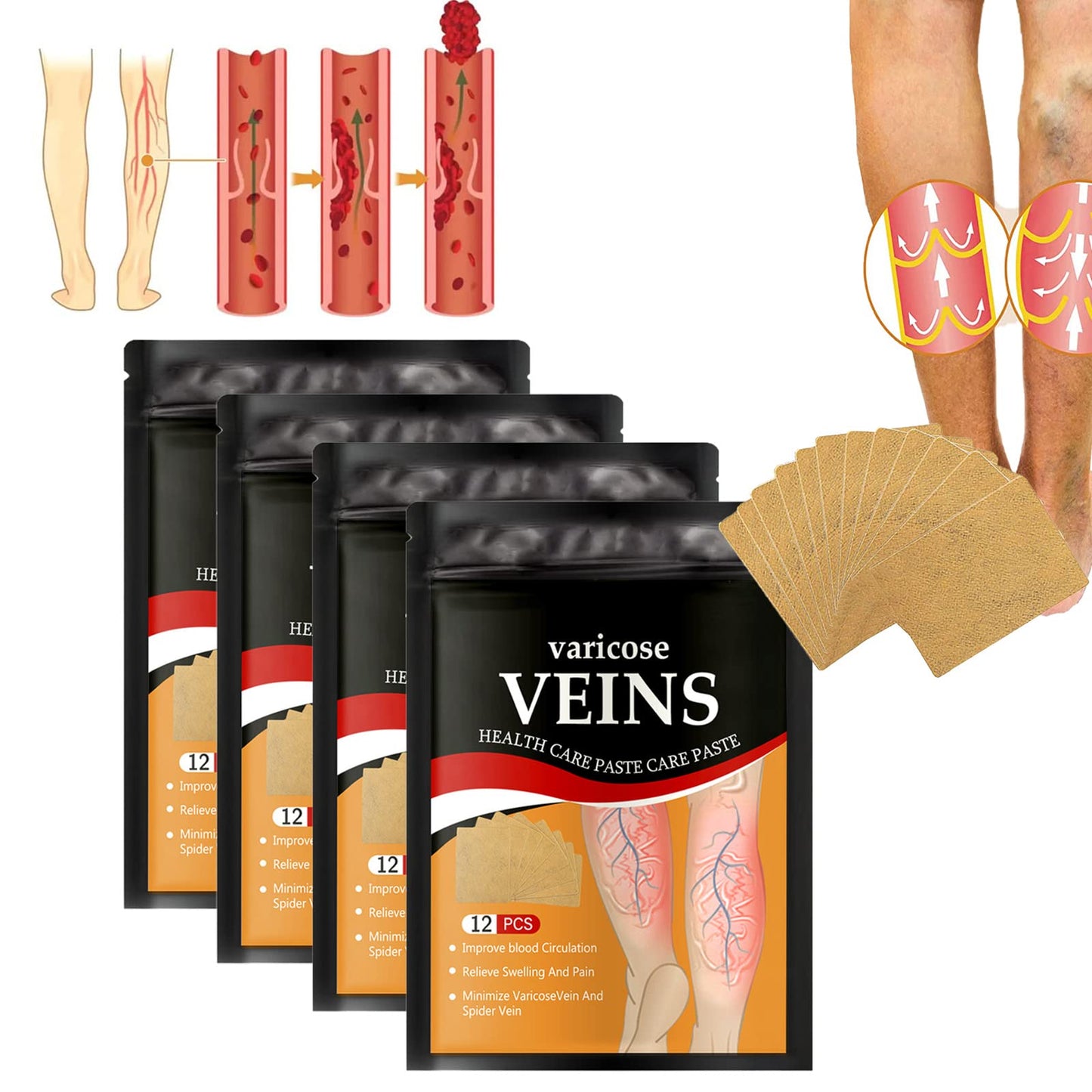 PARCHES PARA VARICES